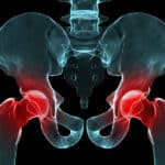 When to See a Doctor for Hip Pain